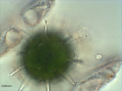 Micrasterias fimbriata zygospore 400X