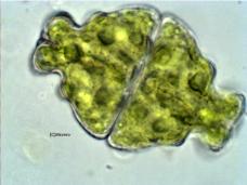 Euastrum ampullaceum 800X tourbire oligotrophe