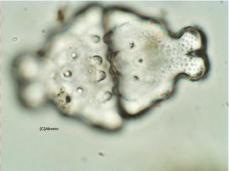 Euastrum ampullaceum 800X cellule vide, attention les trois pores et les cuspides basales